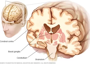 प्रोग्रेसिभ सुपरान्युक्लियर पाल्सी (पीएसपी) कस्तो रोग हो, लक्षण कस्ता हुन्छन् ?